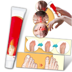 Crème anti-inflammatoire pour oignons du pied