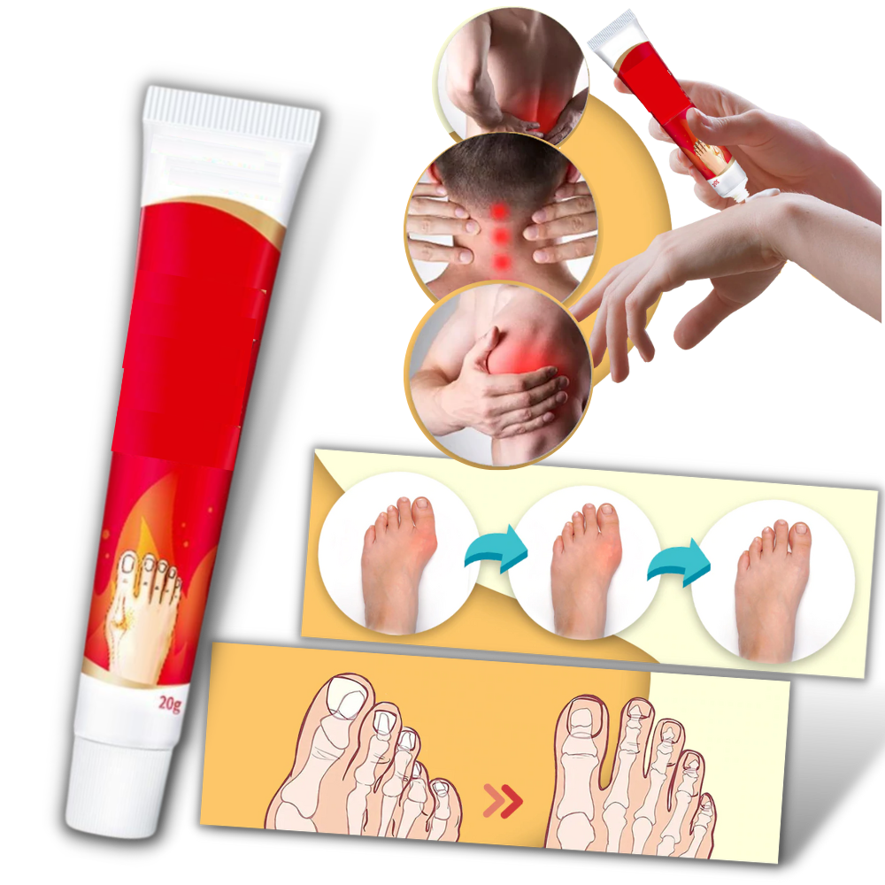 Crème anti-inflammatoire pour oignons du pied