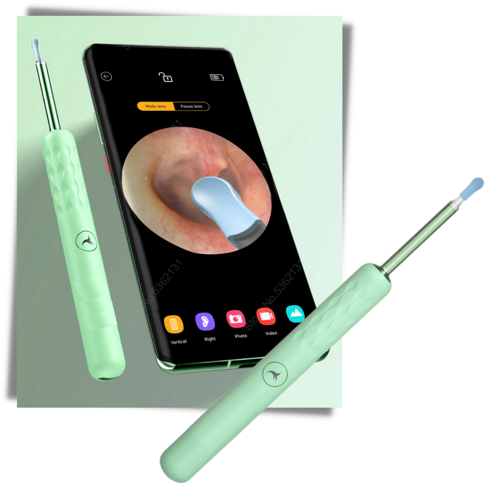Cure Oreille Intelligent