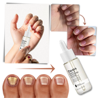 Sérum réparateur pour les ongles en 7 jours