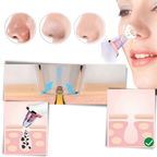 Petit aspirateur extracteur de points noirs
