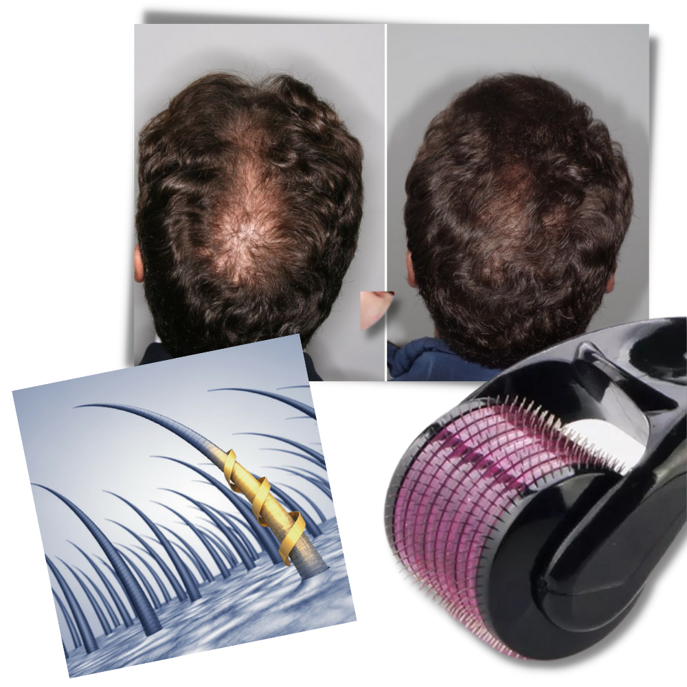 Rouleau dermique pour la croissance des cheveux et de la barbe