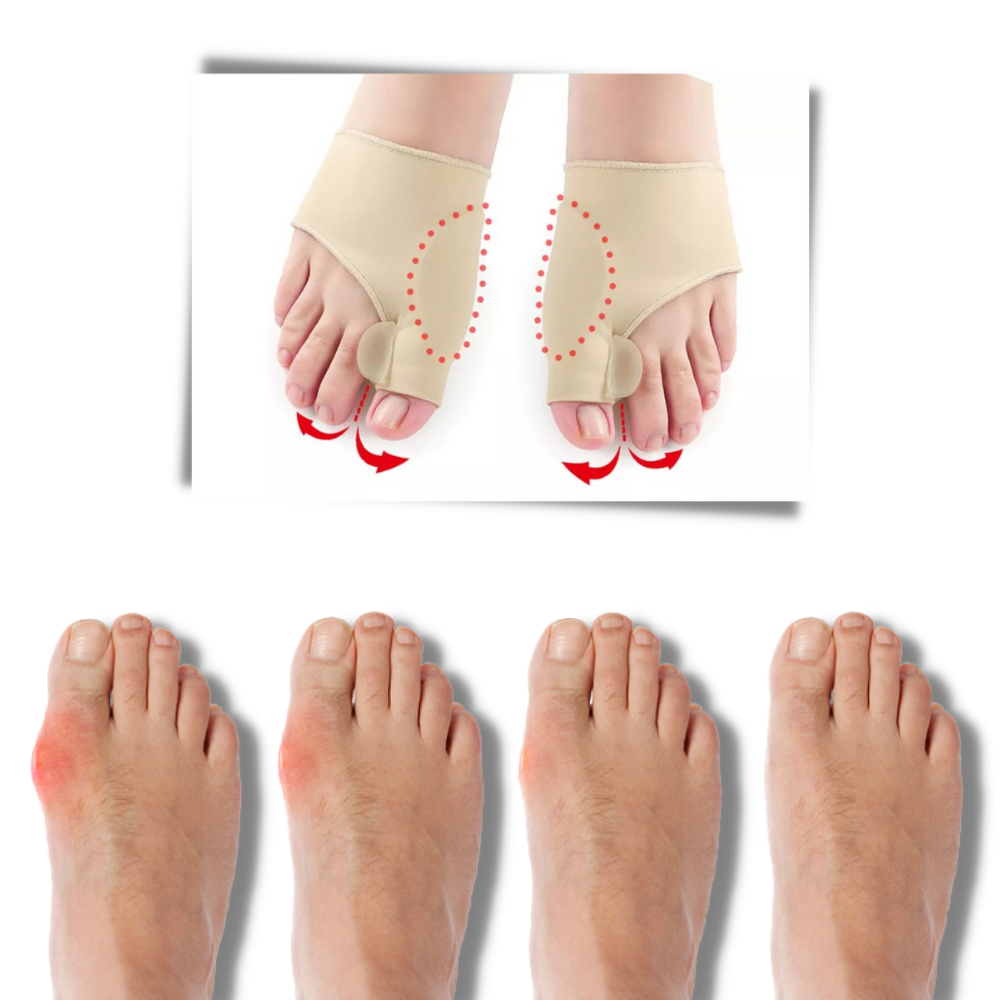 Correcteur d'oignons de pieds en gel