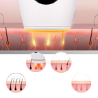 Appareil d'épilation laser IPL