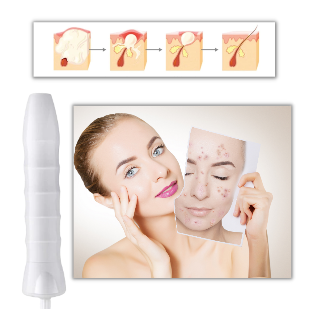 Luminothérapie anti-âge pour la peau