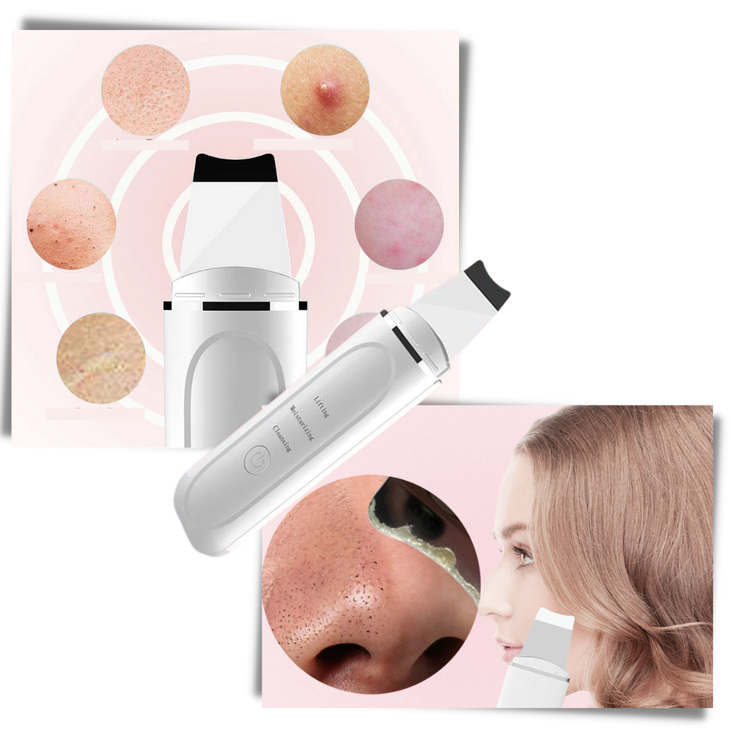 Spatule exfoliante ultrasonique pour le visage