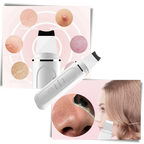 Spatule exfoliante ultrasonique pour le visage