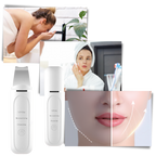 Spatule exfoliante ultrasonique pour le visage