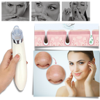 Aspirateur de points noirs du visage