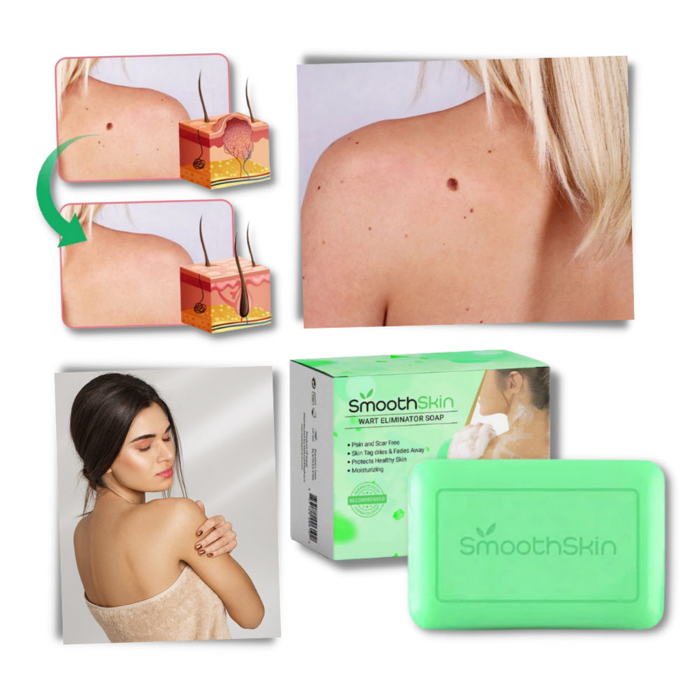 Savon exfoliant hydratant contre les verrues