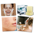 Savon anti acnéique au sel de mer naturel