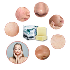Savon anti acnéique au sel de mer naturel