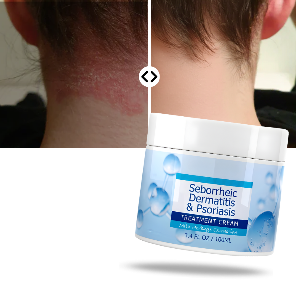 Crème hydratante pour le cuir chevelu