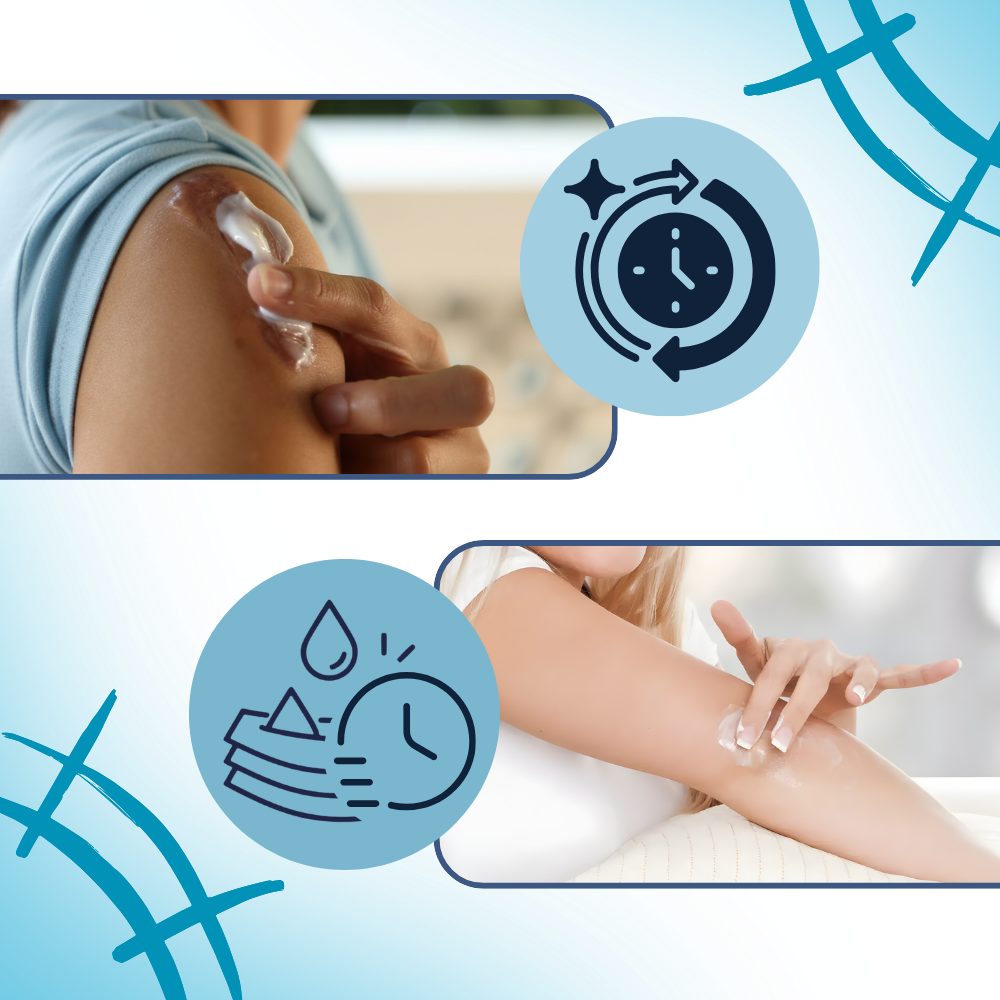 Crème hydratante au silicone pour cicatrices de grossesse