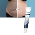 Crème hydratante au silicone pour cicatrices de grossesse