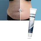 Crème hydratante au silicone pour cicatrices de grossesse