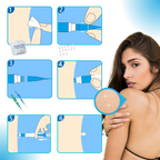 Kit de Traitement Pro des Acrochordons