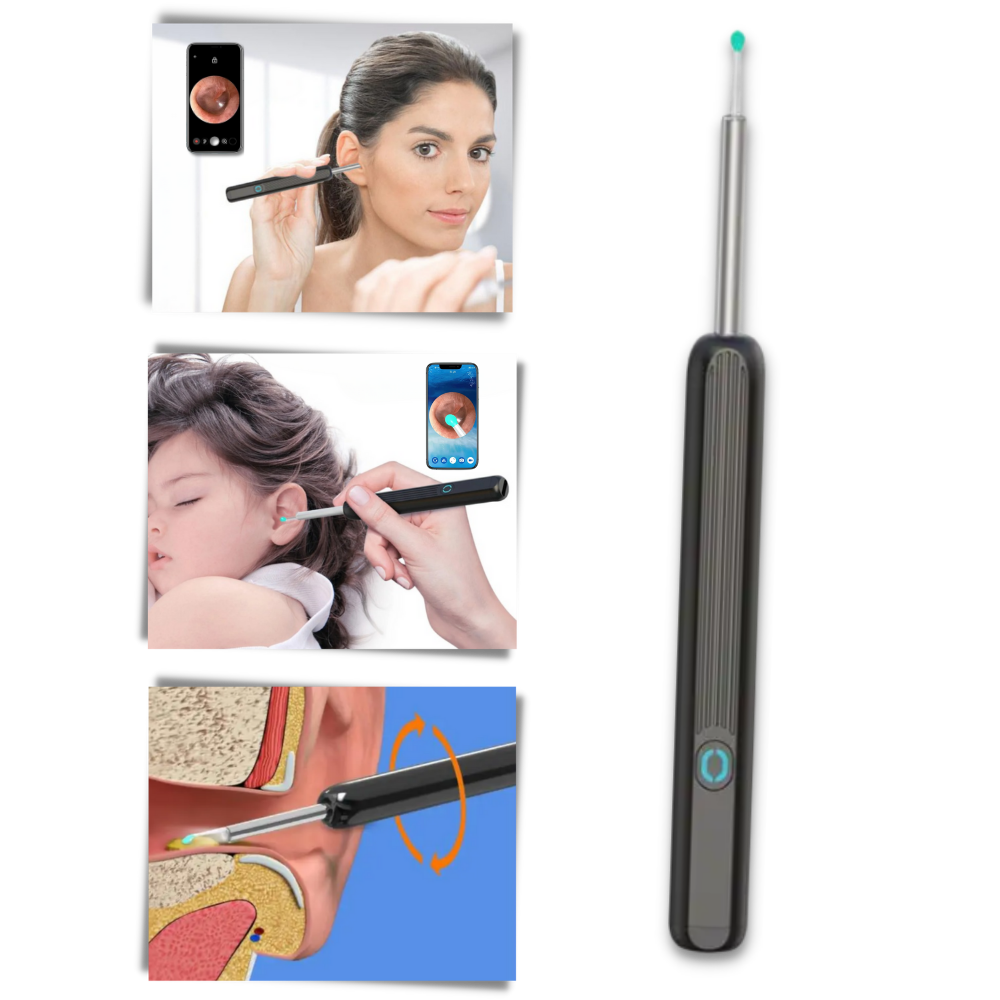 Caméra de nettoyage d'oreille pour retirer le cérumen