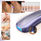 Appareil d'épilation laser